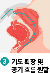 �⵵ Ȯ�� �� ���� �帧 ��Ȱ