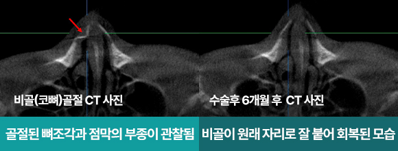 ������ ���Ļ��� 1