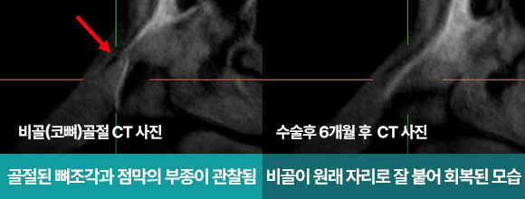 ������ ���Ļ��� 2