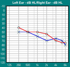 ¿Àµð¿À ±×·¥